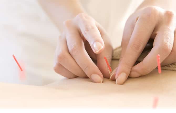 経絡治療写真